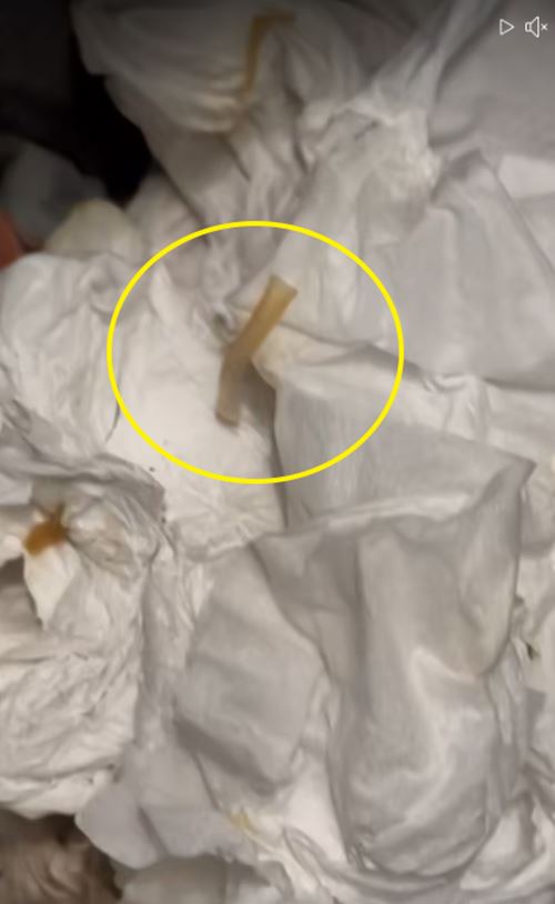 ปล้องสุกของพยาธิตัวตืด ปล้องสุกของพยาธิตัวตืด