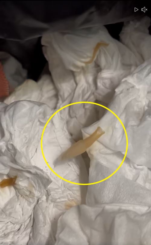 ปล้องสุกของพยาธิตัวตืด ปล้องสุกของพยาธิตัวตืด