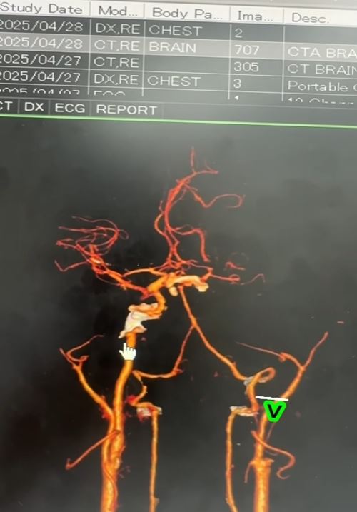 ผัวให้เมียนวด สุดท้ายตื่นมาแขนขาอ่อนแรง สมองตาย ผัวให้เมียนวด สุดท้ายตื่นมาแขนขาอ่อนแรง สมองตาย