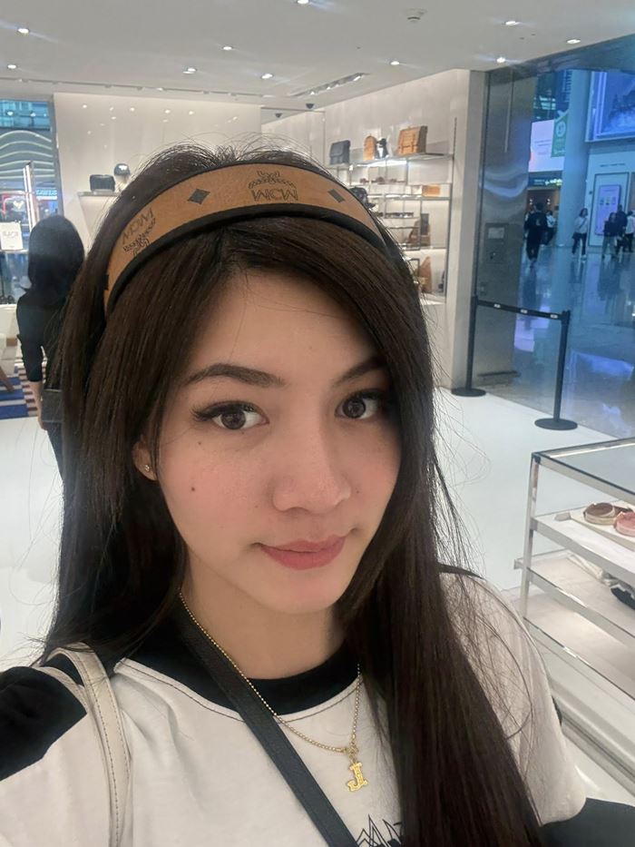 สาวแชร์ประสบการณ์แพ้ฟิลเลอร์ ปากบวม สุดทรมาน สาวแชร์ประสบการณ์แพ้ฟิลเลอร์ ปากบวม สุดทรมาน