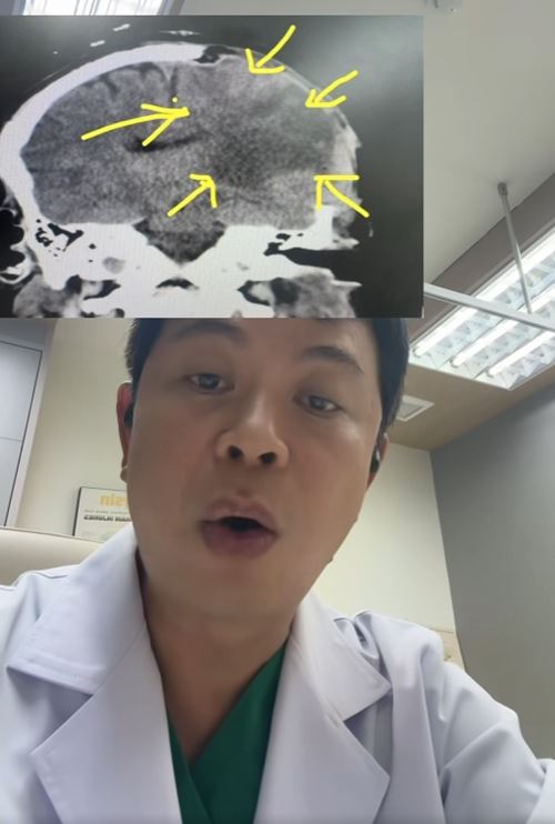 ผัวให้เมียนวด สุดท้ายตื่นมาแขนขาอ่อนแรง สมองตาย ผัวให้เมียนวด สุดท้ายตื่นมาแขนขาอ่อนแรง สมองตาย