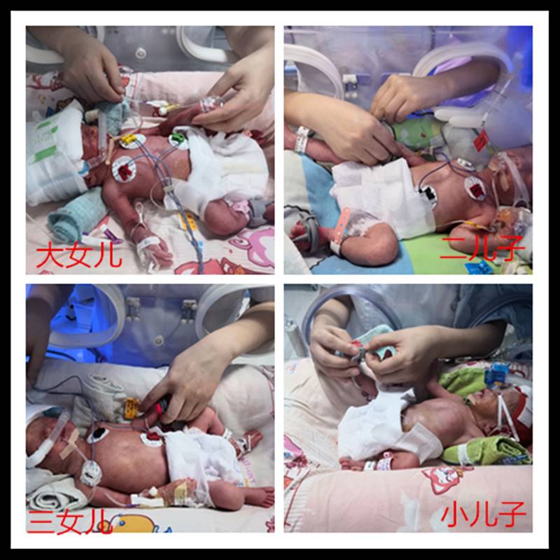 แฝดสี่ แฝดสี่