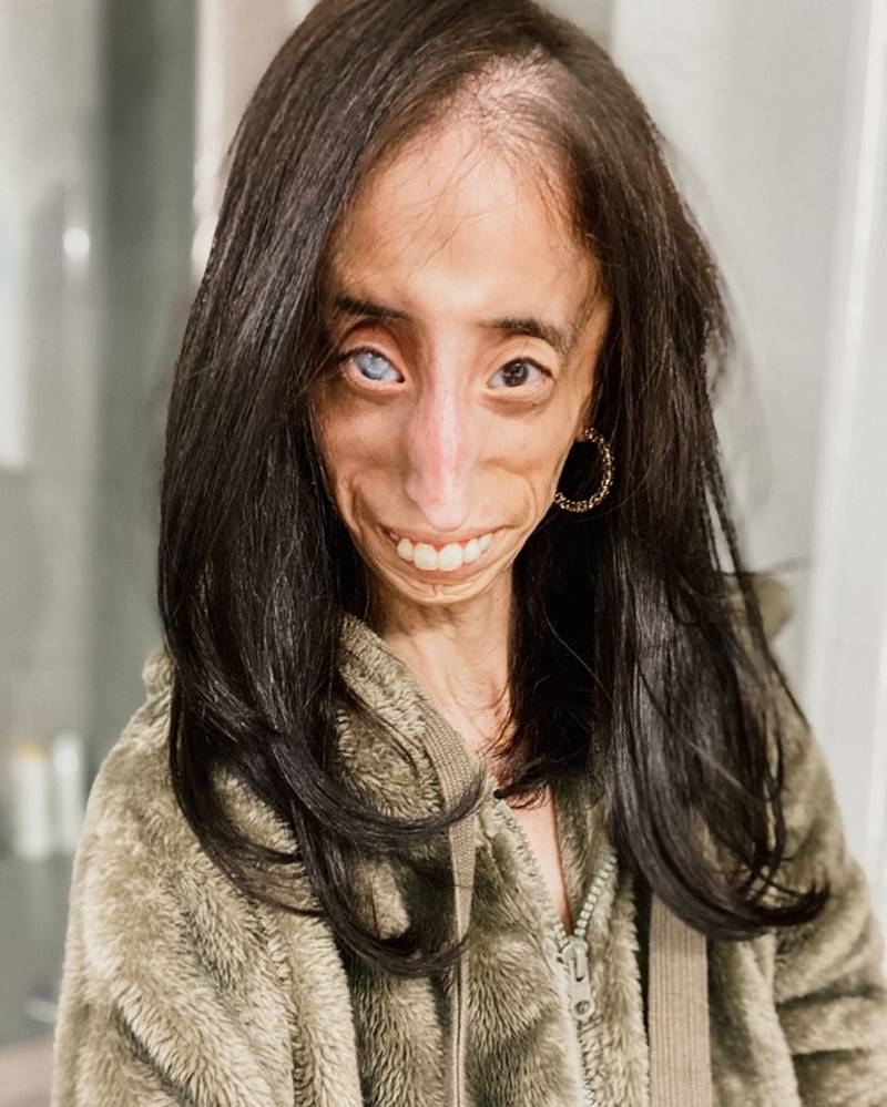 หญิงที่น่าเกลียดที่สุดในโลก หญิงที่น่าเกลียดที่สุดในโลก