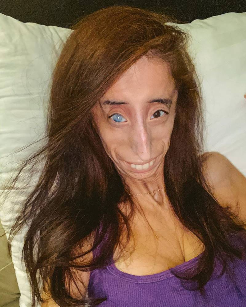 หญิงที่น่าเกลียดที่สุดในโลก หญิงที่น่าเกลียดที่สุดในโลก