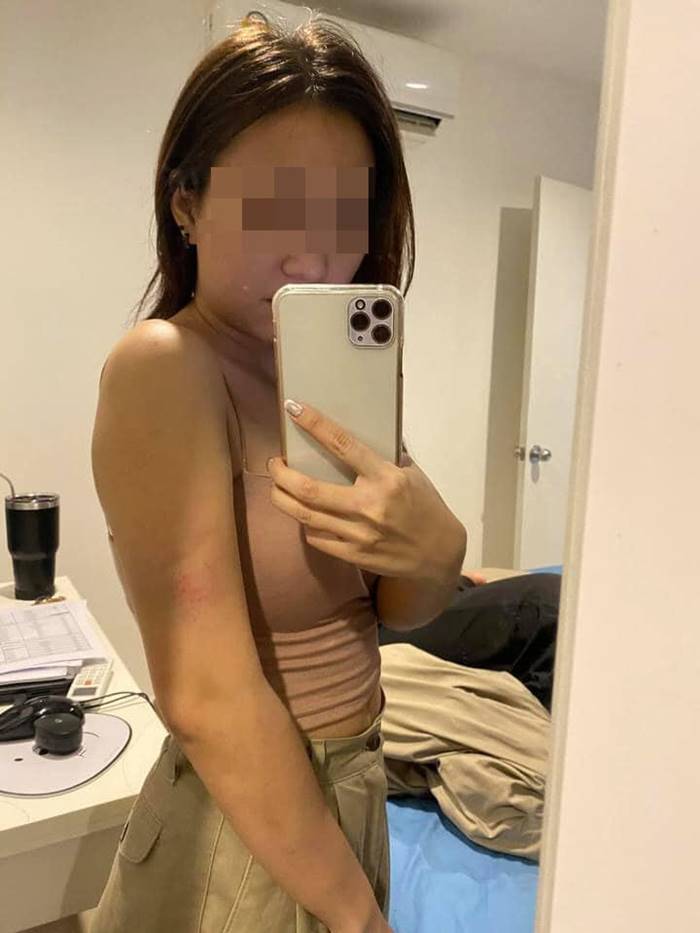 ทำร้ายแฟน ทำร้ายแฟน