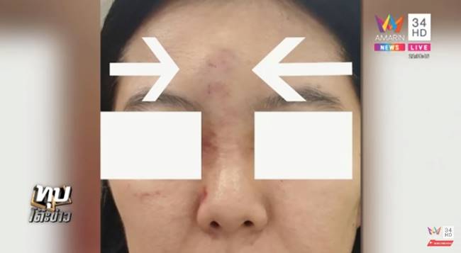 มรดกเลือด มรดกเลือด