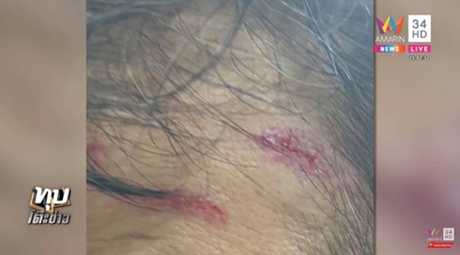 มรดกเลือด มรดกเลือด