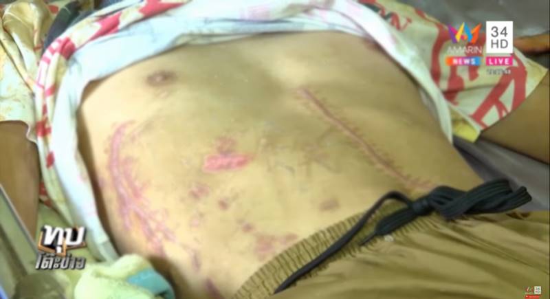 เมาแล้วขับ เมาแล้วขับ