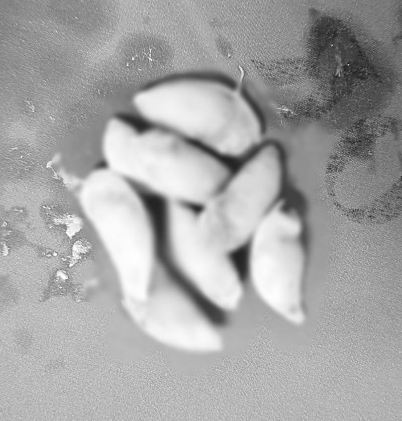 เม็ดกระท้อน เม็ดกระท้อน