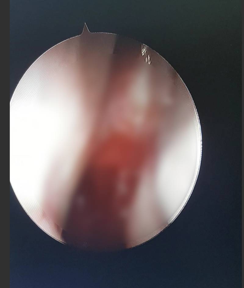 เจลล้างมือ เจลล้างมือ