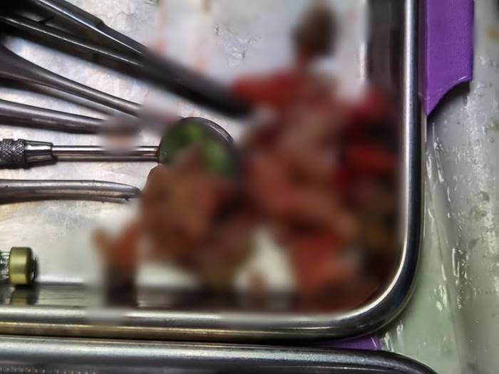 ฟันปลอมเถื่อน ฟันปลอมเถื่อน