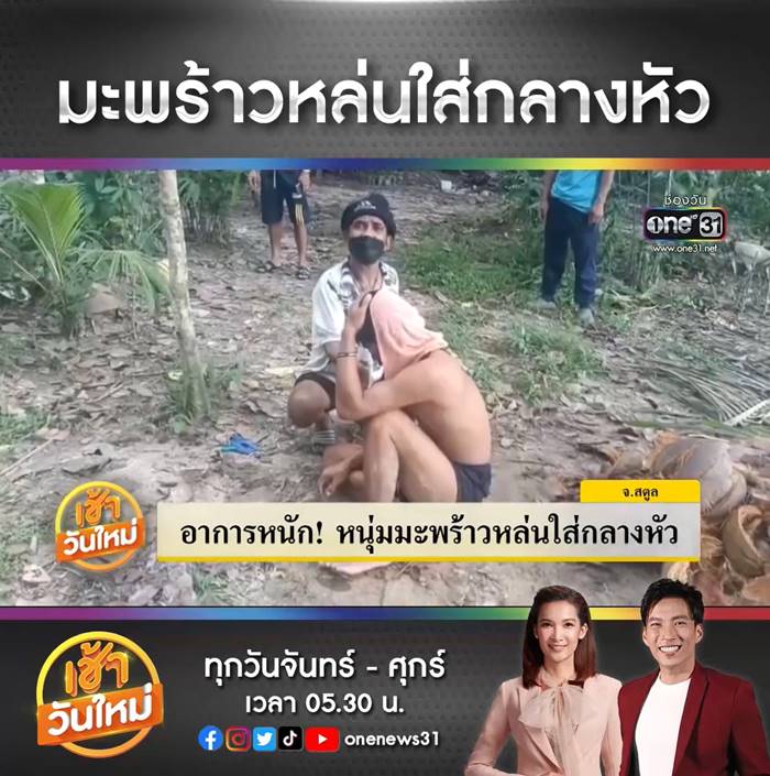 มะพร้าวตกใส่หัว มะพร้าวตกใส่หัว