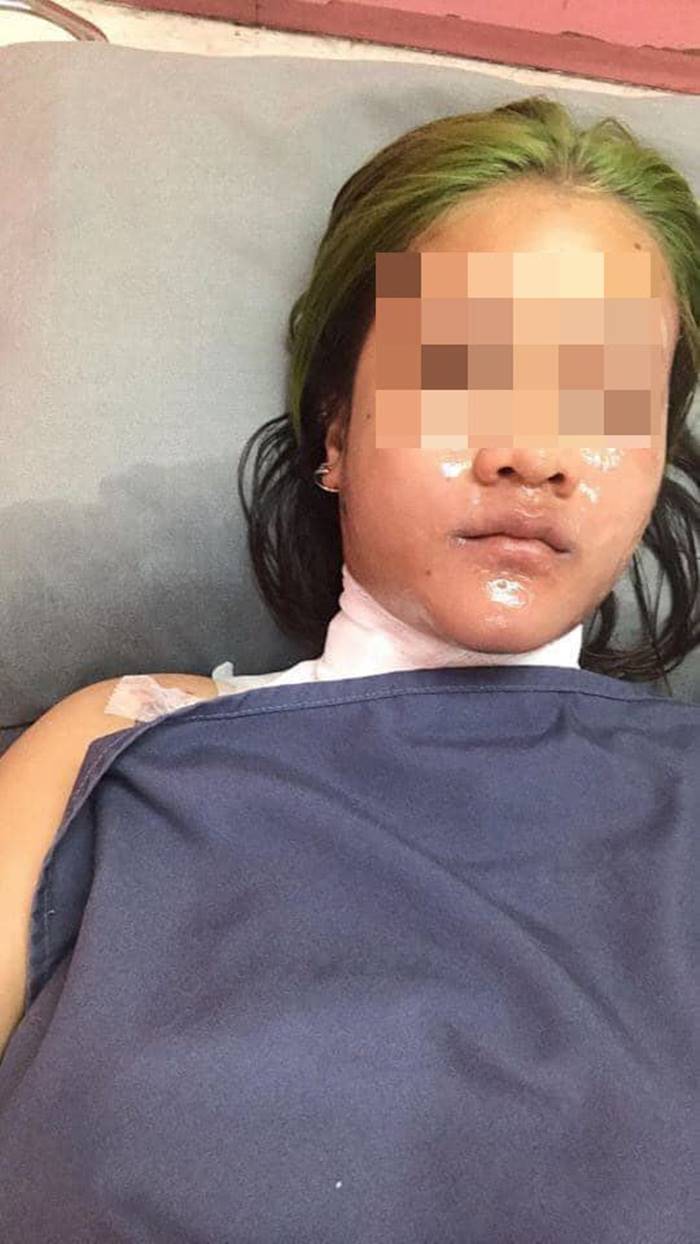 ต้มไข่ไมโครเวฟ ต้มไข่ไมโครเวฟ