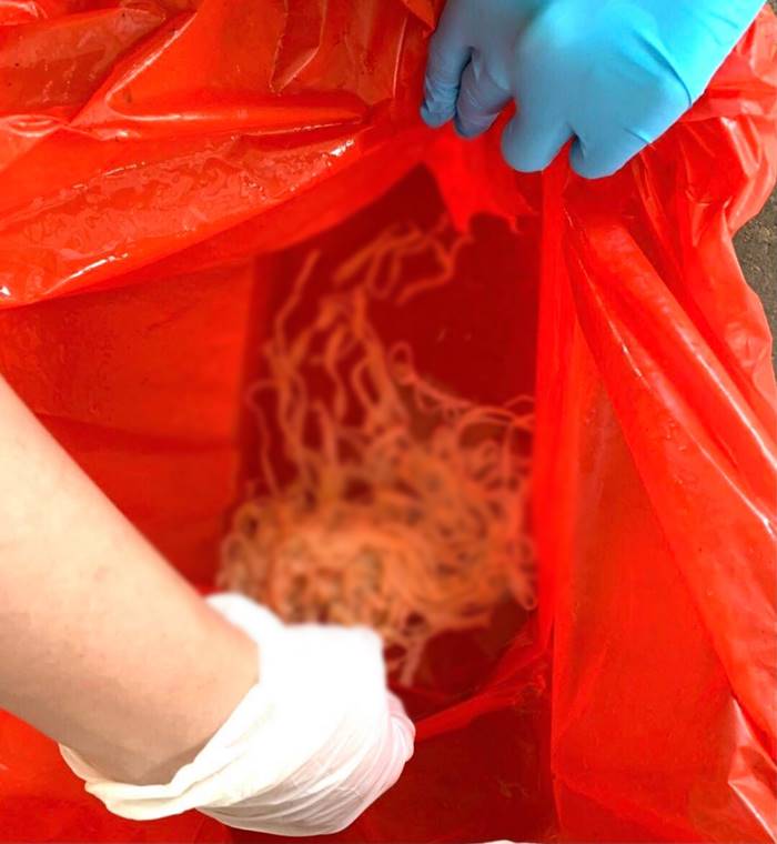 พยาธิตัวตืด พยาธิตัวตืด