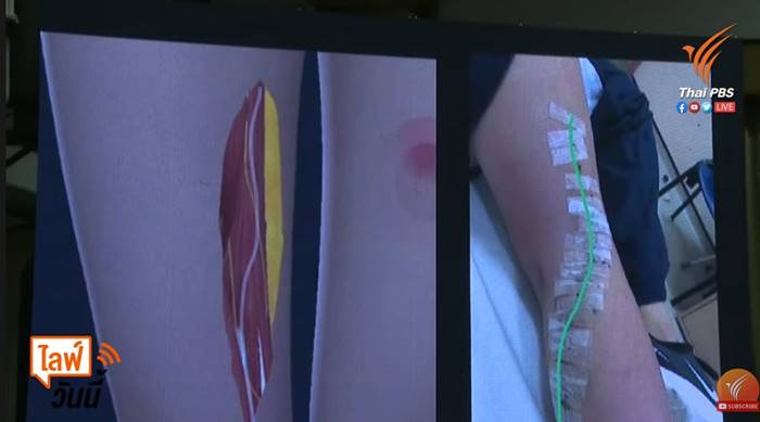 แตงโม นิดา แตงโม นิดา