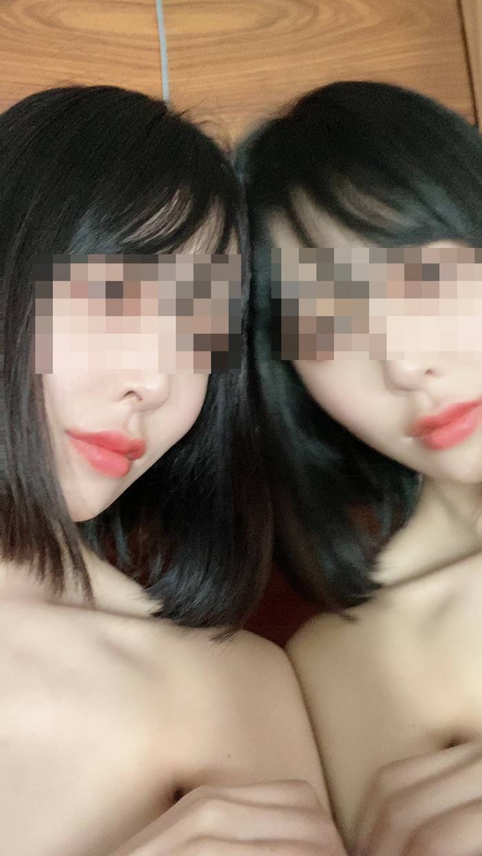 เลเซอร์กำจัดขน เลเซอร์กำจัดขน