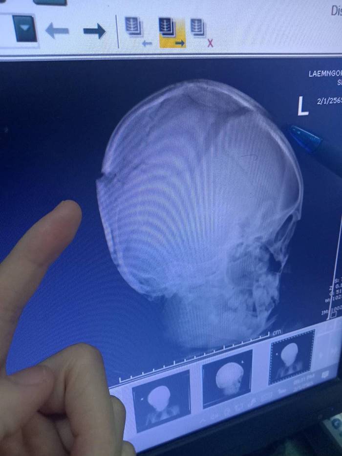 พ่อเลี้ยงทำร้ายลูกเลี้ยง พ่อเลี้ยงทำร้ายลูกเลี้ยง