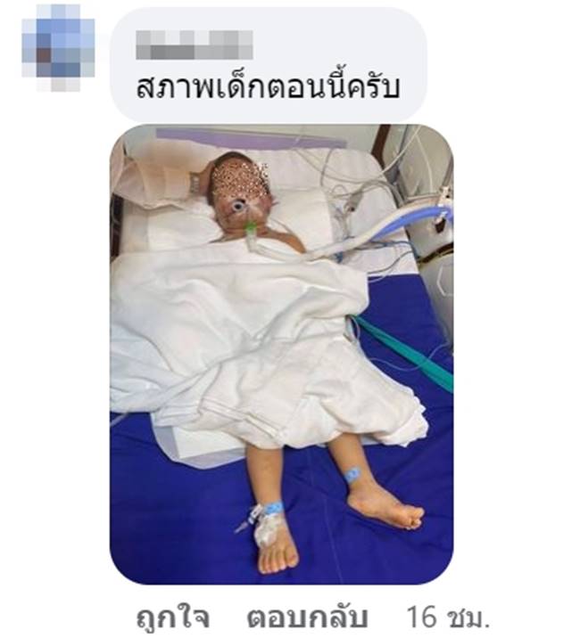 พิตบูลกัดเด็ก พิตบูลกัดเด็ก
