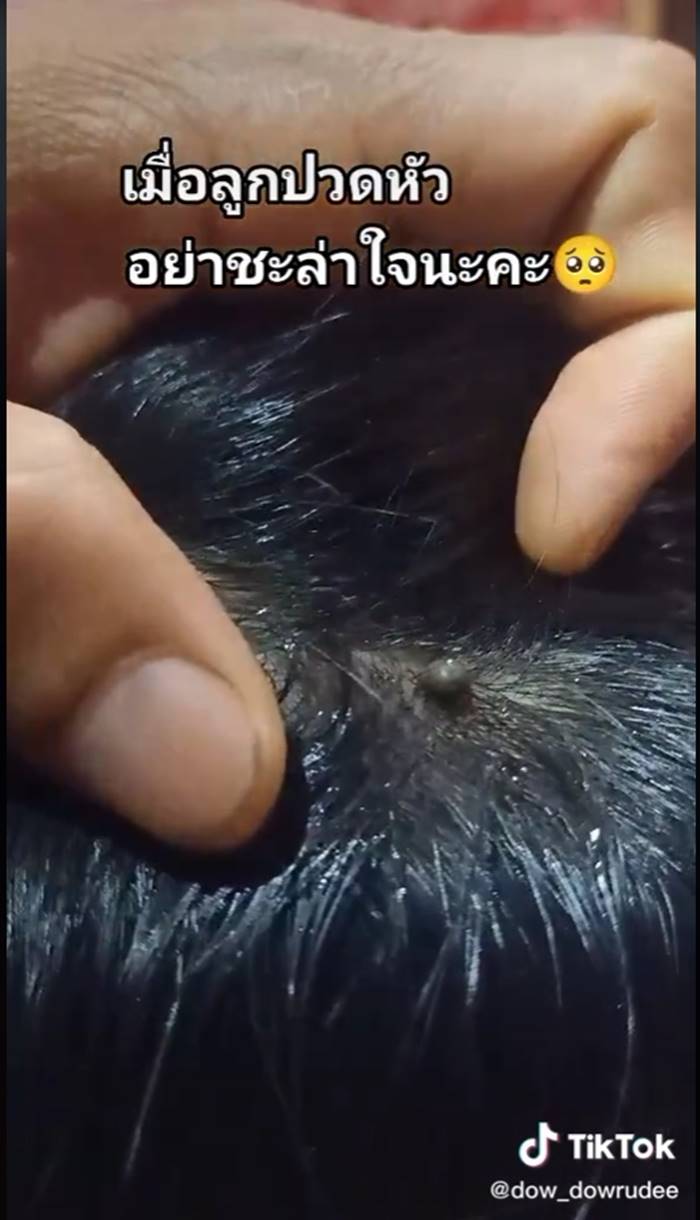 เห็บ เห็บ