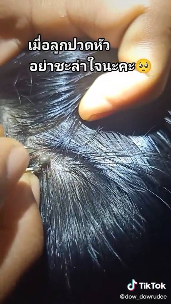 เห็บ เห็บ