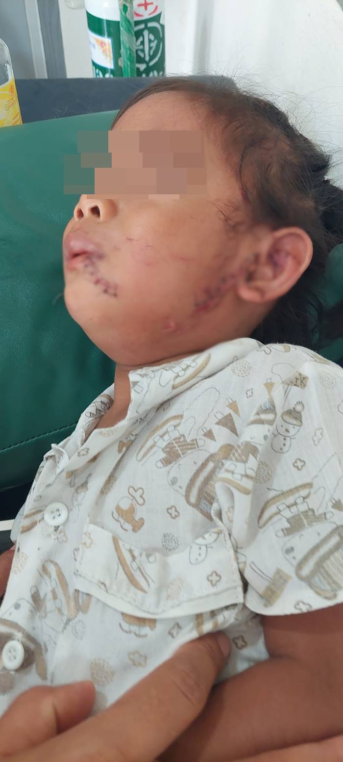 หมากัดคน หมากัดคน