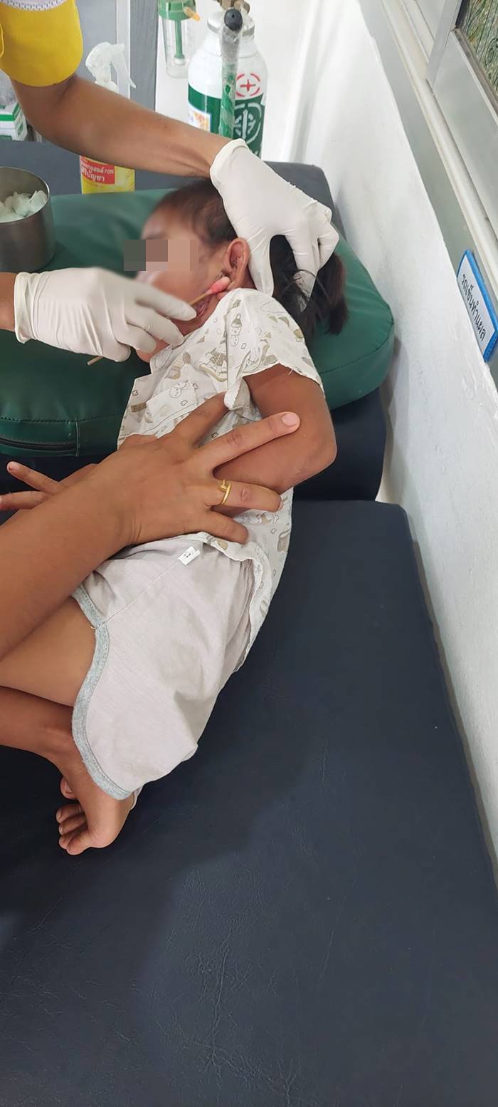 หมากัดคน หมากัดคน