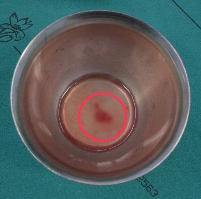 ปวดหลัง ปวดหลัง