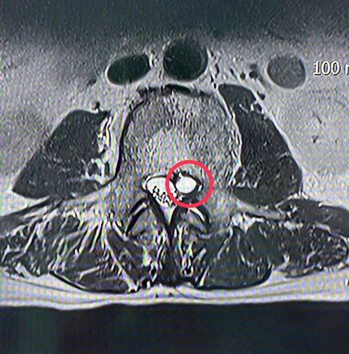 ปวดหลัง ปวดหลัง