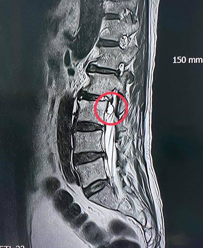 ปวดหลัง ปวดหลัง