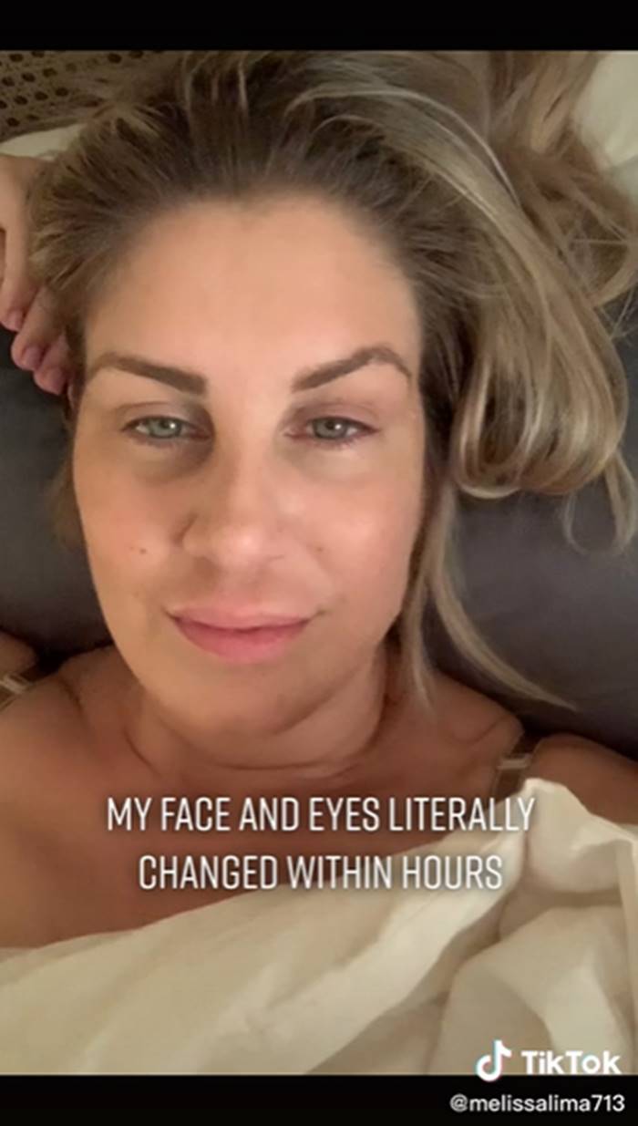 เสริมหน้าอก เสริมหน้าอก