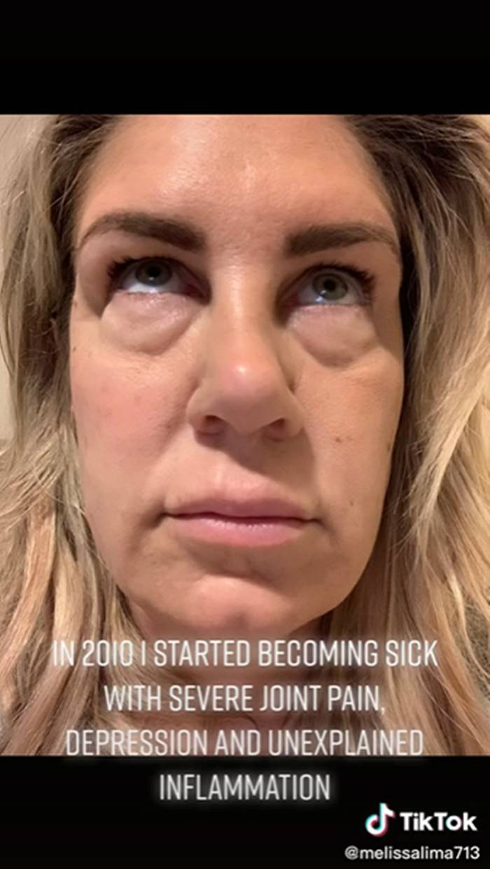 เสริมหน้าอก เสริมหน้าอก