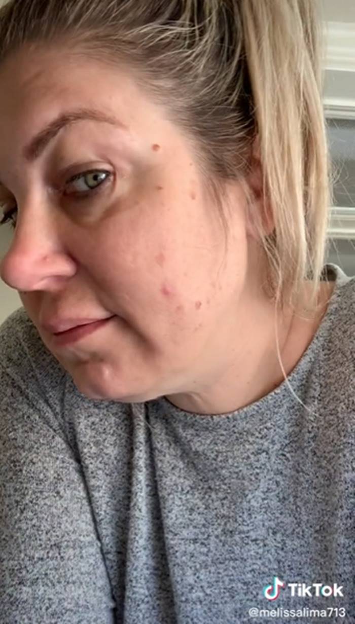 เสริมหน้าอก เสริมหน้าอก