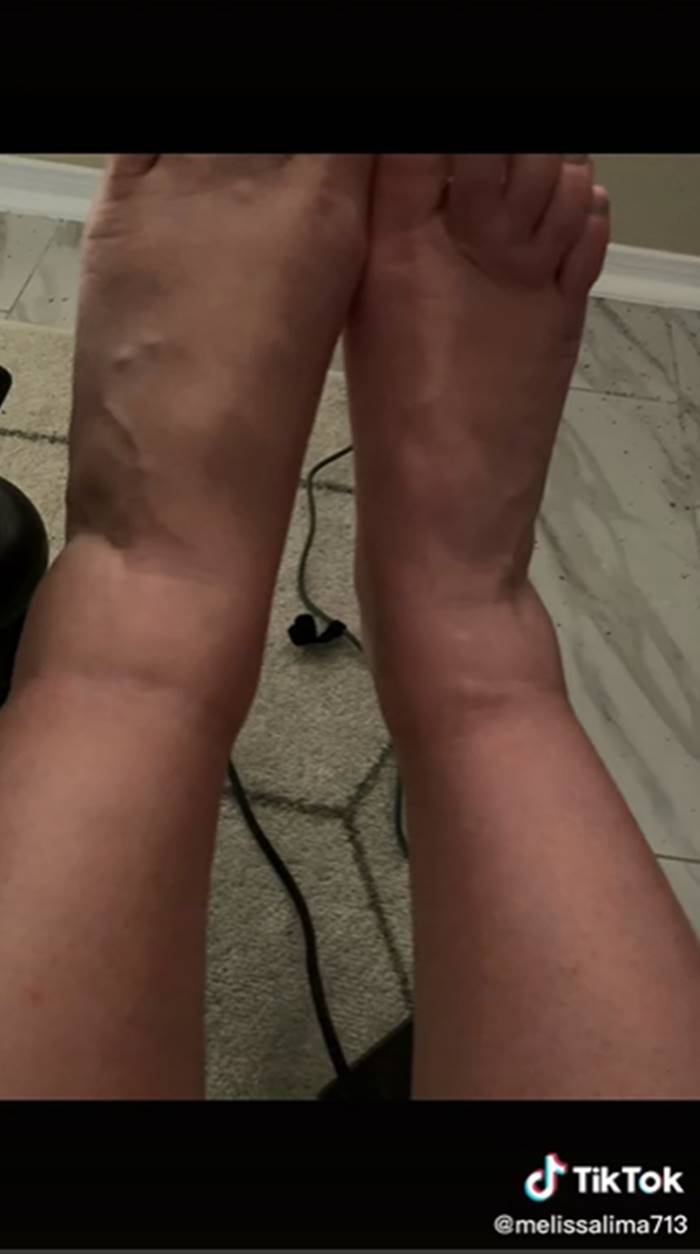 เสริมหน้าอก เสริมหน้าอก