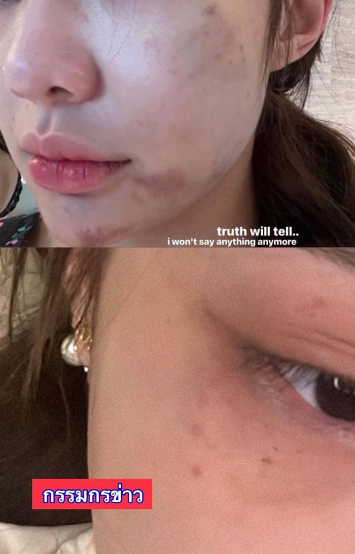 จีจี้ สุพิชชา, เรื่องของจี้ จีจี้ สุพิชชา, เรื่องของจี้