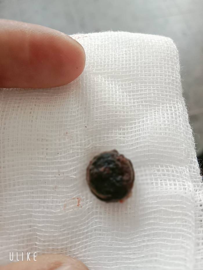 ถ่านของเล่น ถ่านของเล่น