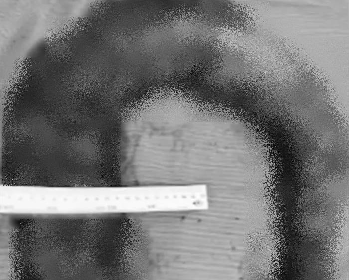 ท้องผูก ท้องผูก