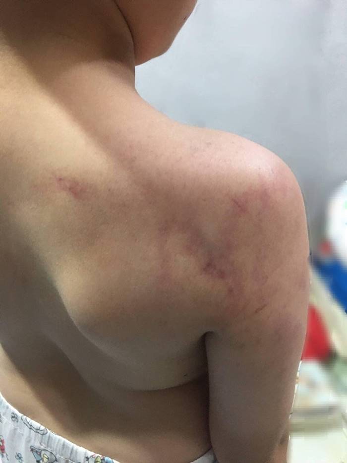 ครูทำร้ายนักเรียน ครูทำร้ายนักเรียน