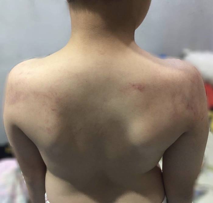 ครูทำร้ายนักเรียน ครูทำร้ายนักเรียน