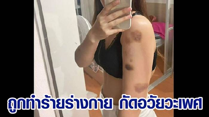 ทำร้ายร่างกายผู้หญิง ทำร้ายร่างกายผู้หญิง