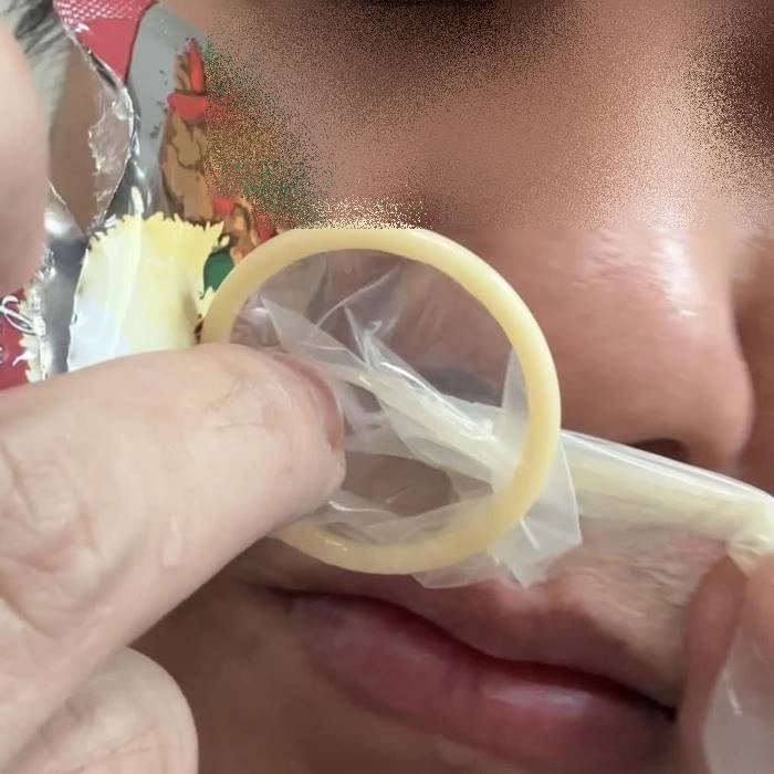 ถุงยางอนามัย ถุงยางอนามัย