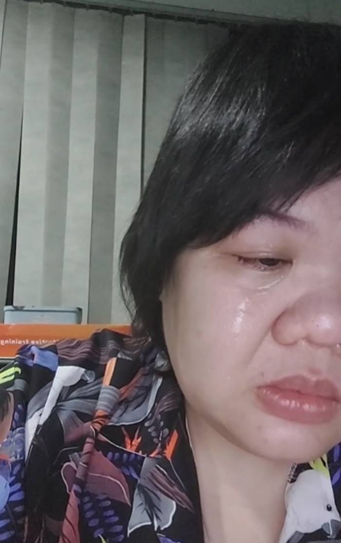 เส้นเลือดในสมองแตก เส้นเลือดในสมองแตก