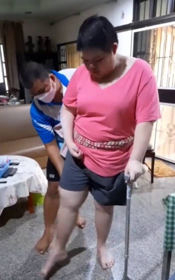 เส้นเลือดในสมองแตก เส้นเลือดในสมองแตก