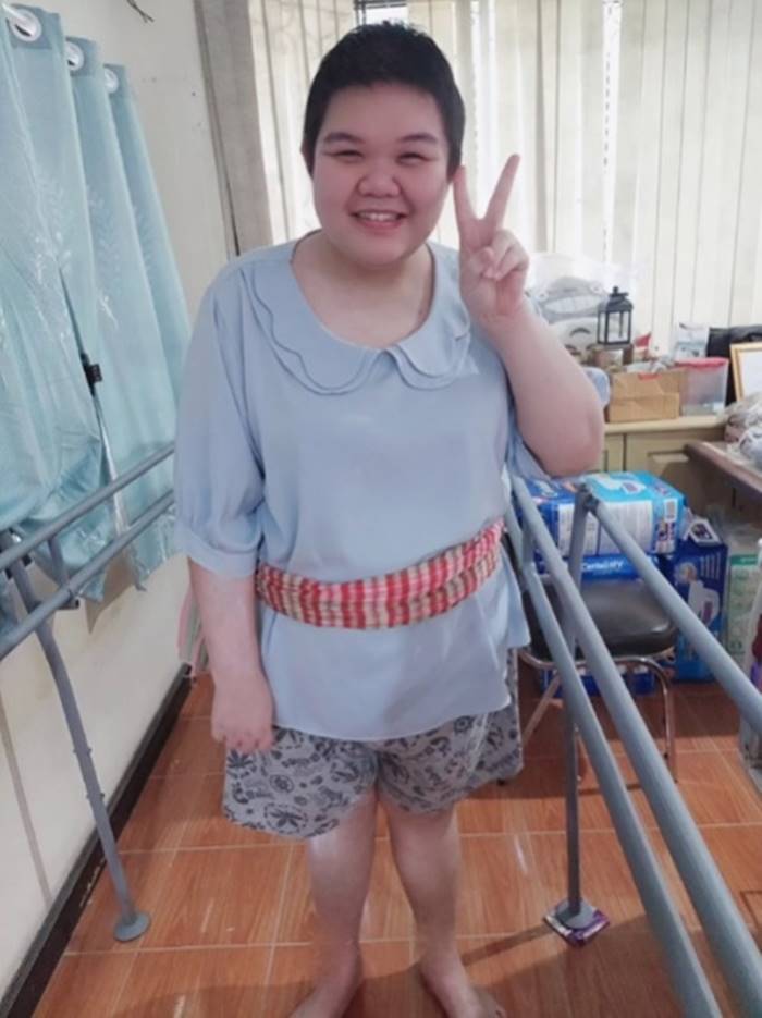 เส้นเลือดในสมองแตก เส้นเลือดในสมองแตก