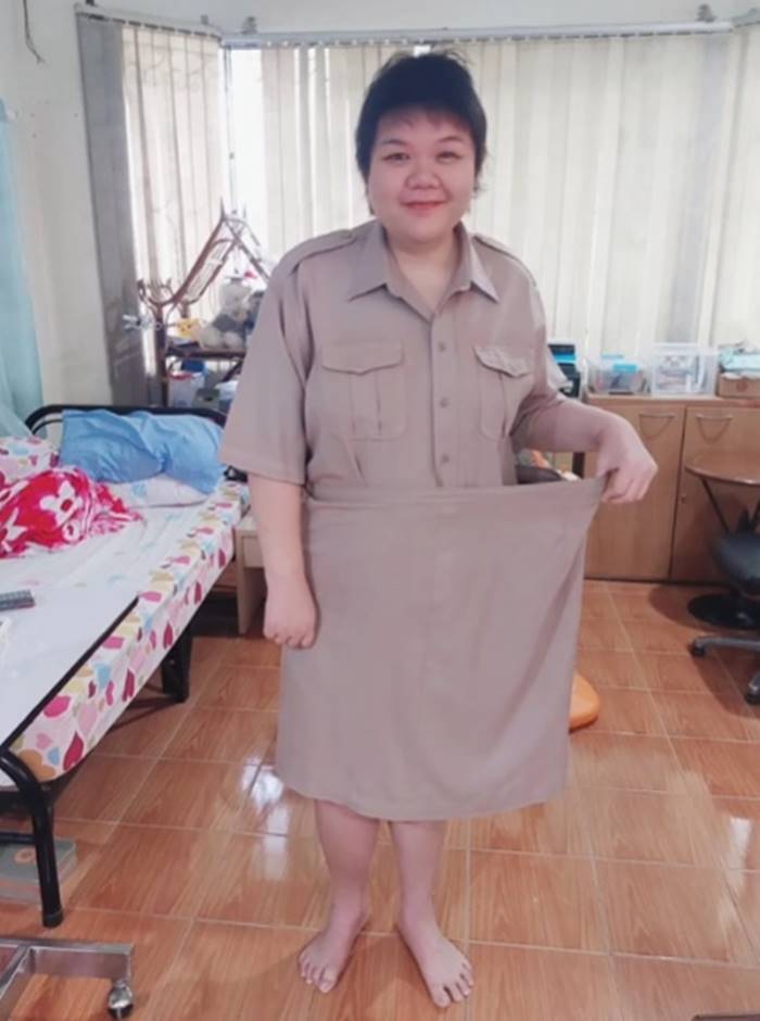 เส้นเลือดในสมองแตก เส้นเลือดในสมองแตก