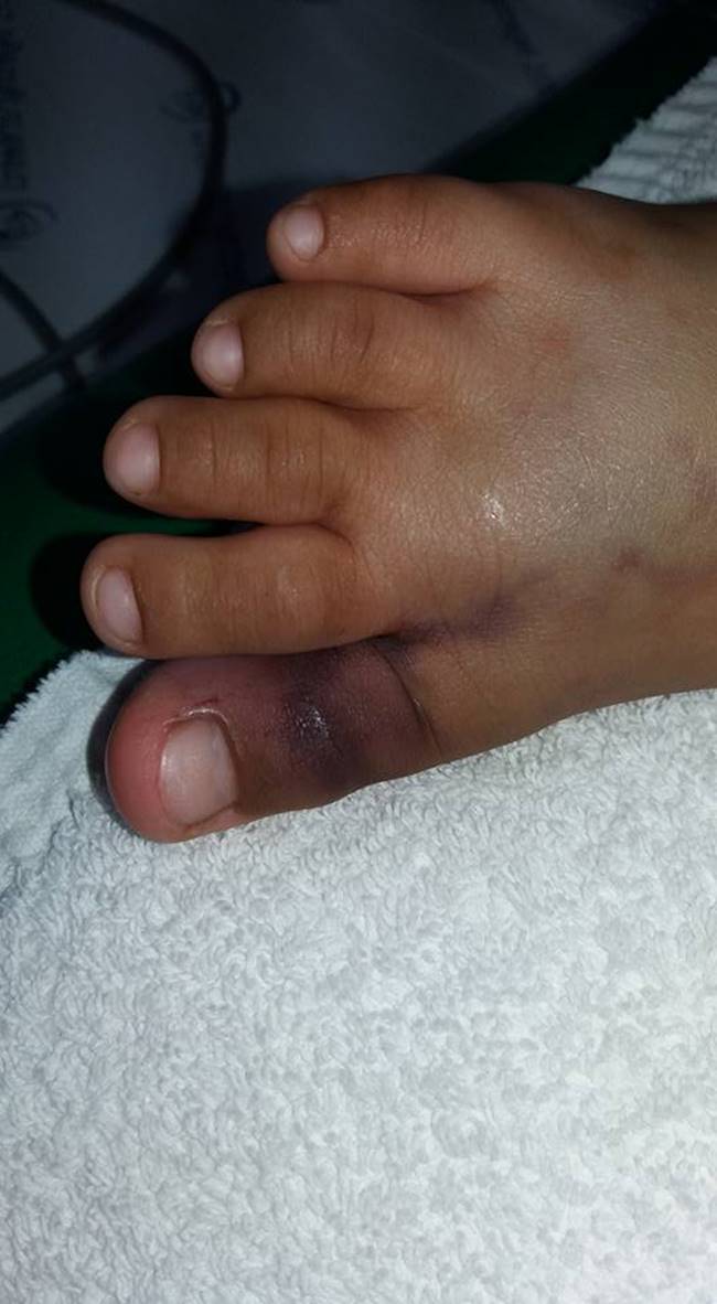 งูเห่ากัด งูเห่ากัด