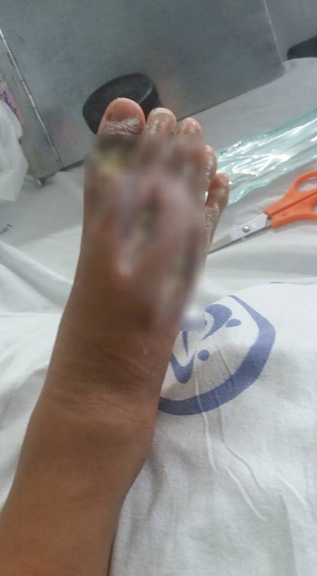 งูเห่ากัด งูเห่ากัด