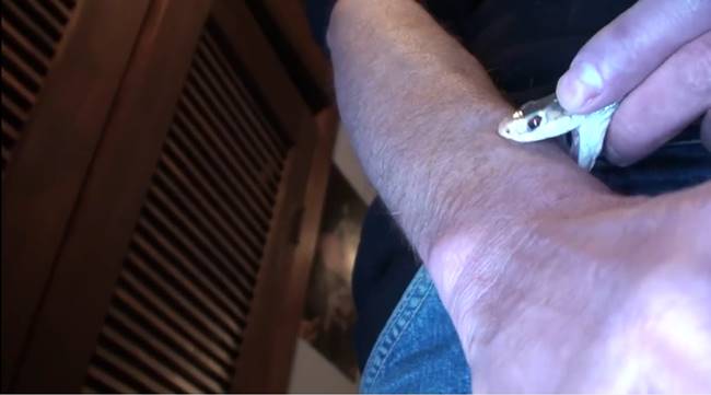 งูกัด งูกัด