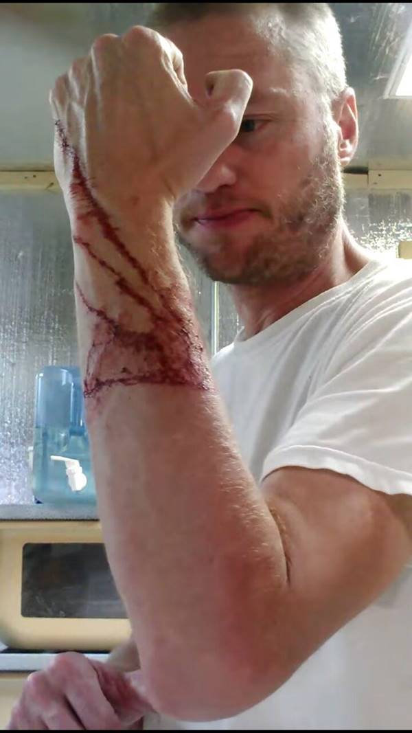 งูกัด งูกัด