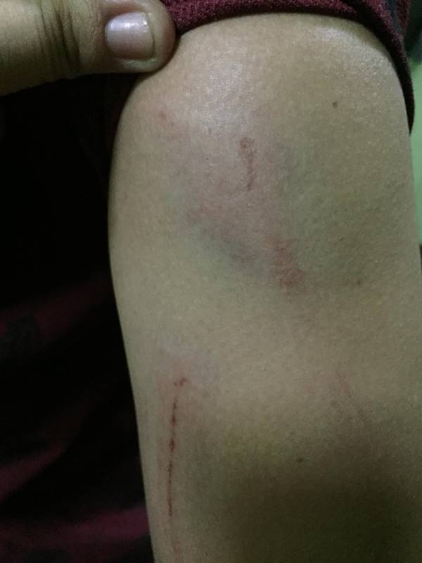 แท็กซี่ทำร้ายผู้โดยสาร แท็กซี่ทำร้ายผู้โดยสาร