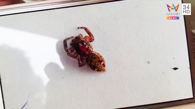 แมงมุมกัด แมงมุมกัด